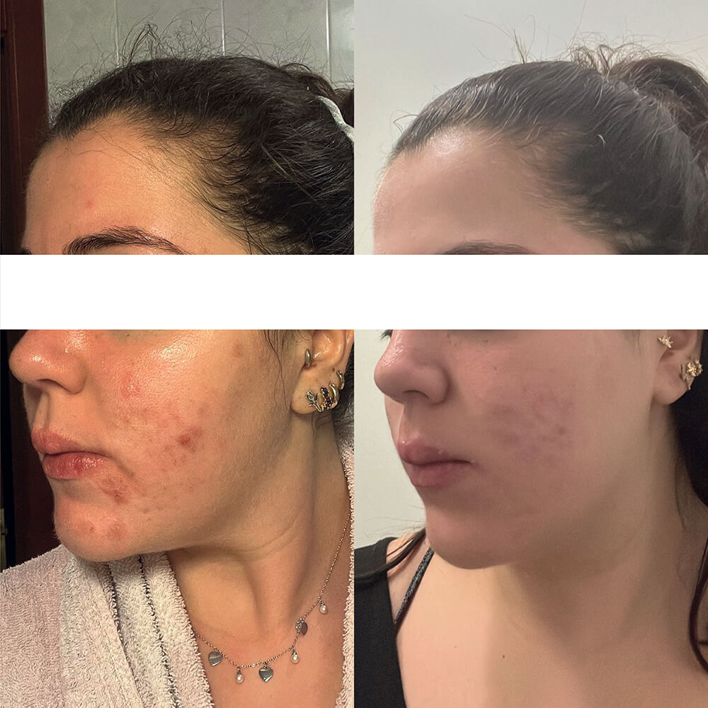 risultati prodotti Kubla