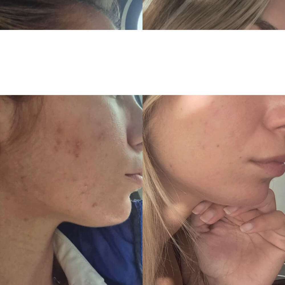 risultati bundle Kubla maschera e olio