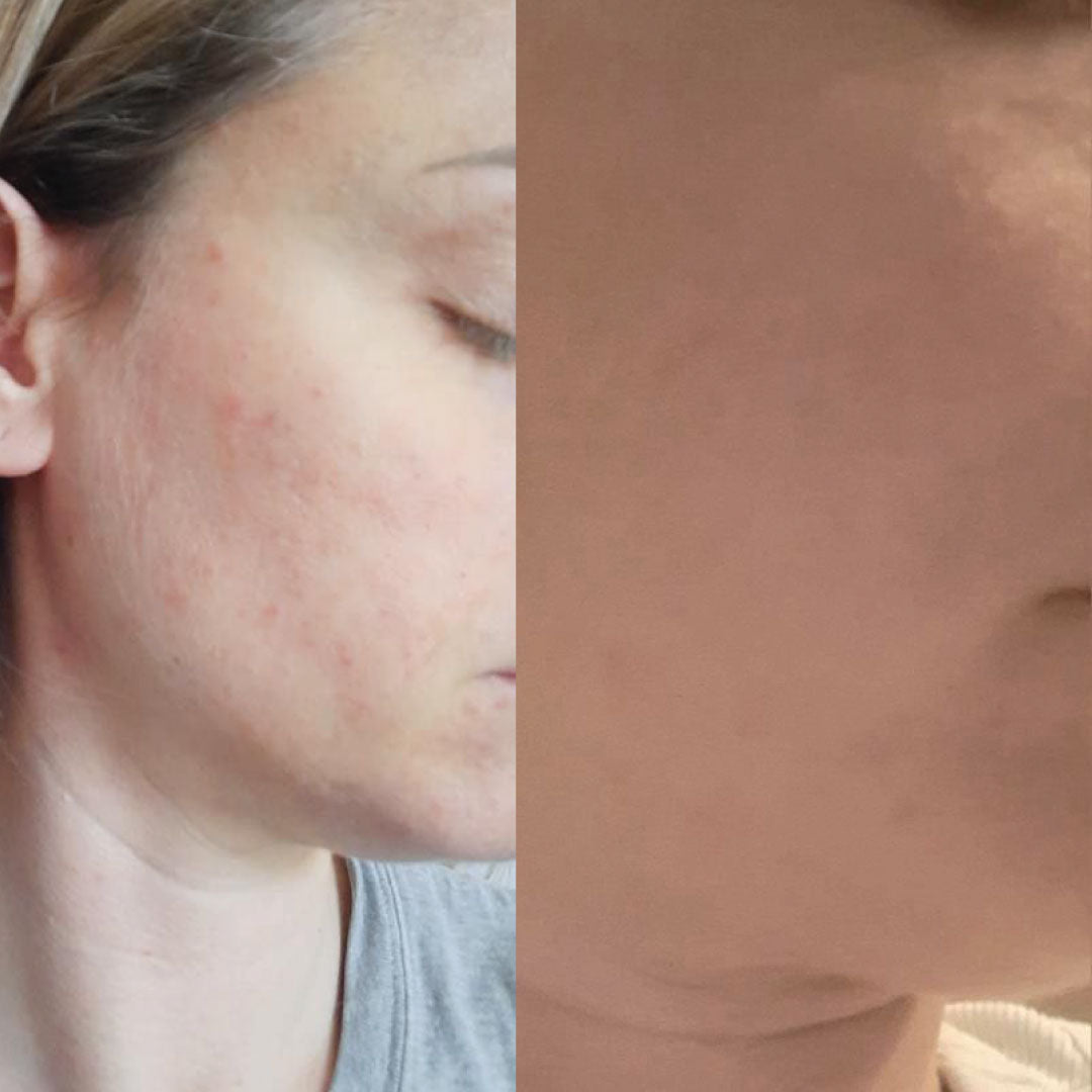 risultati prodotti kubla sul viso