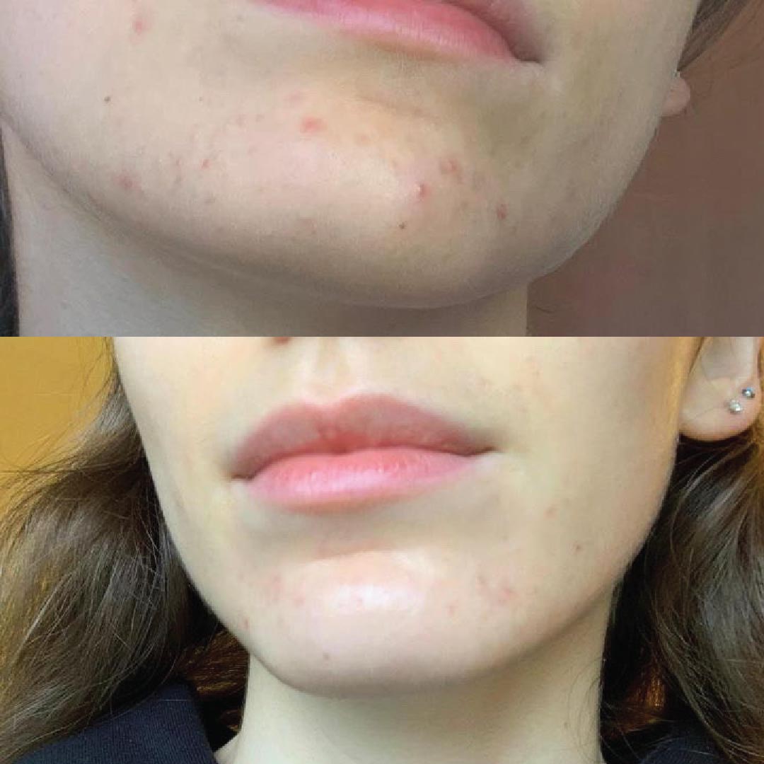 risultati applicazione cosmetici kubla