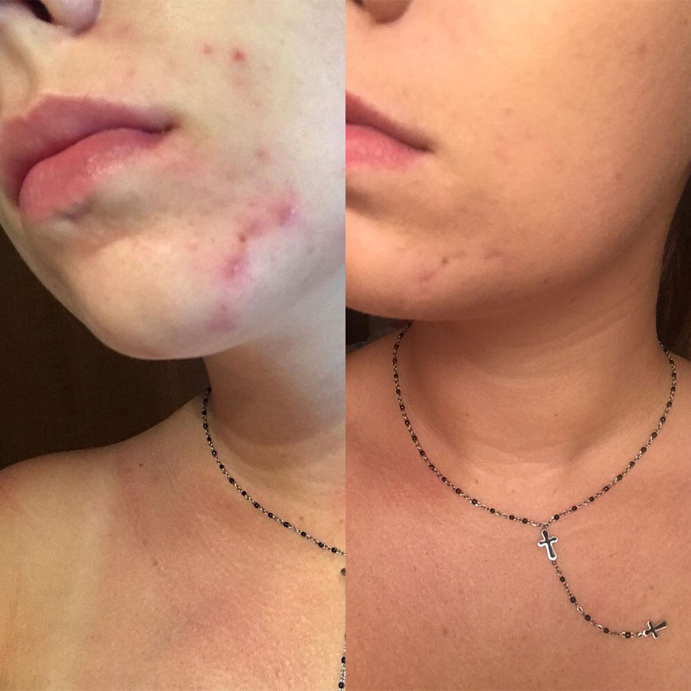 risultati bundle Kubla