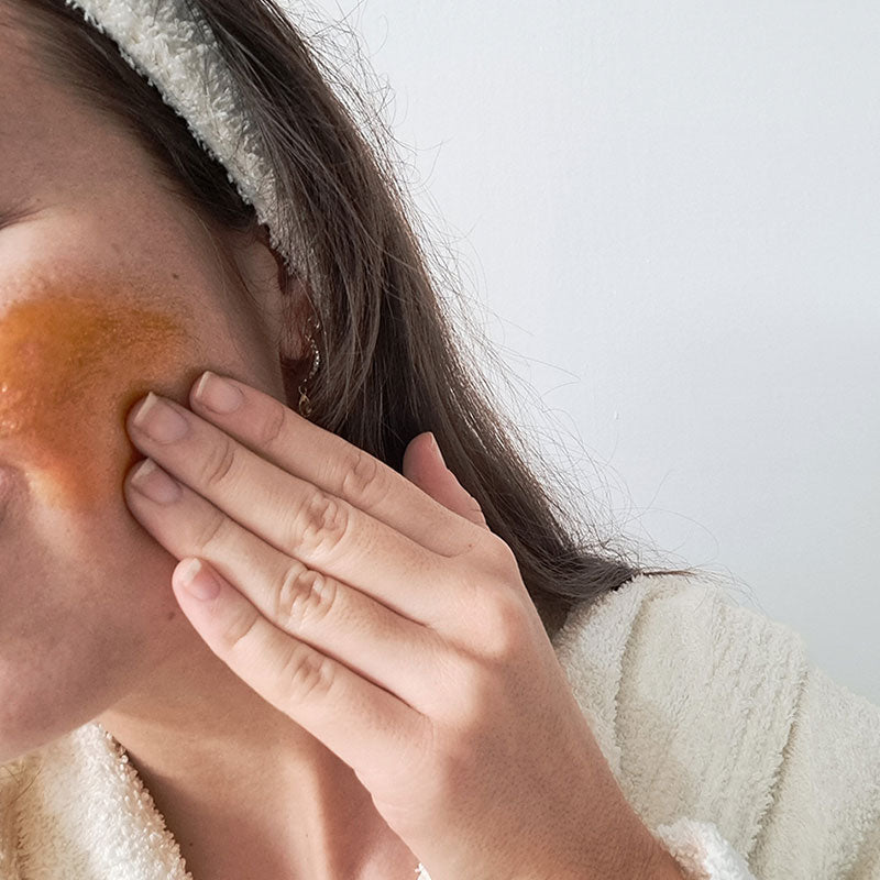 trattamenti serali acne