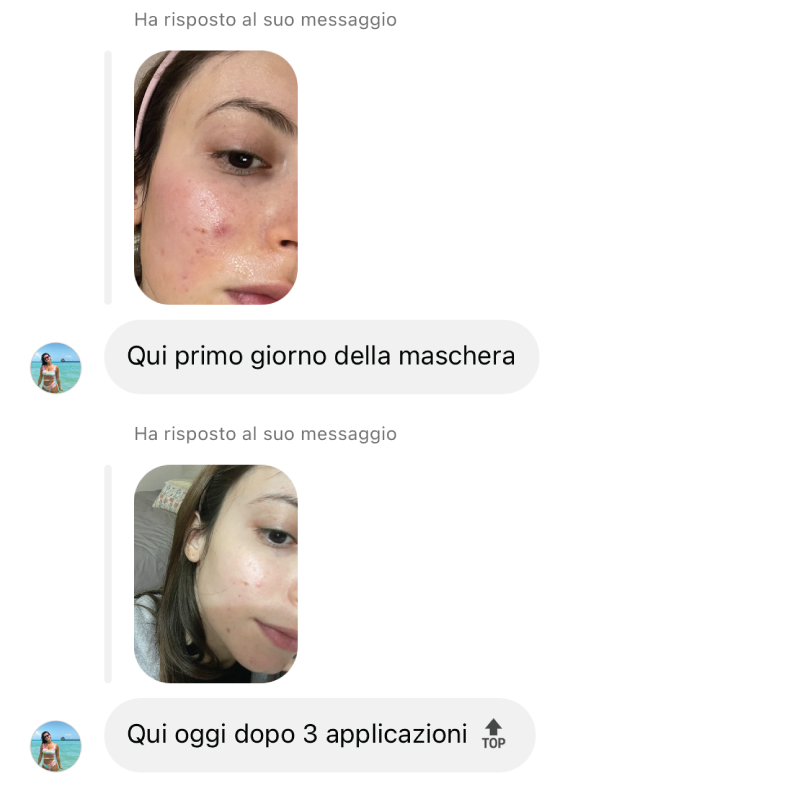 risultati skincare kubla prima e dopo